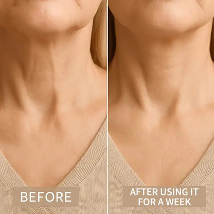 LiftLine™ Instant Neck Lift Strips