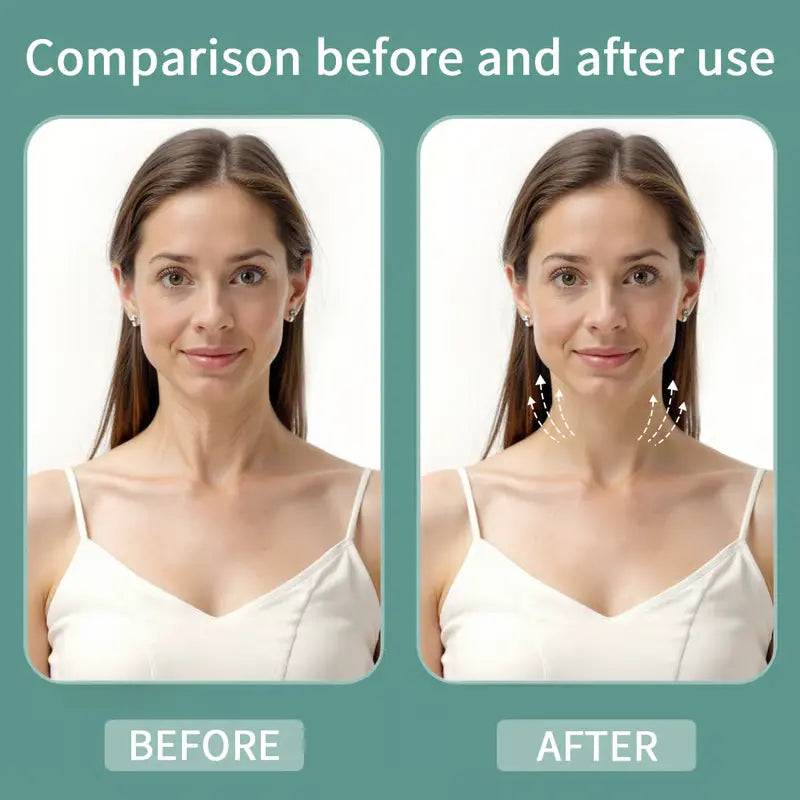 LiftLine™ Instant Neck Lift Strips