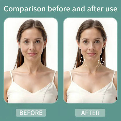 LiftLine™ Instant Neck Lift Strips