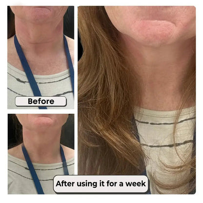LiftLine™ Instant Neck Lift Strips